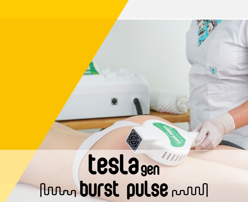 Teslagen Burst Pulse